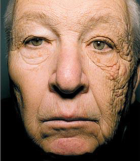 Trucker-driver-sunscreen-damage-28-years